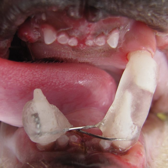 Bloqueio maxilo-mandibular com resina associado à amarria interdental com fio de aço entre caninos inferiores de um gato.